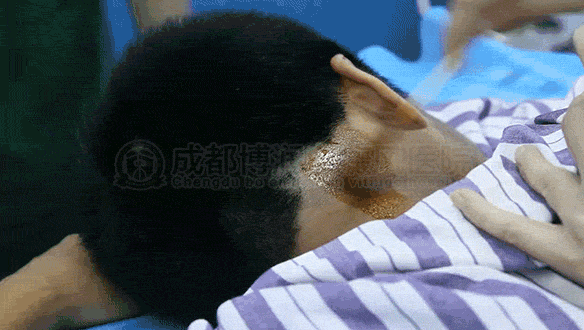 兰主任毛囊外根鞘_技术单页(1).gif